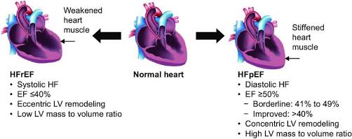 The visual difference between HFrEF and HFpEF